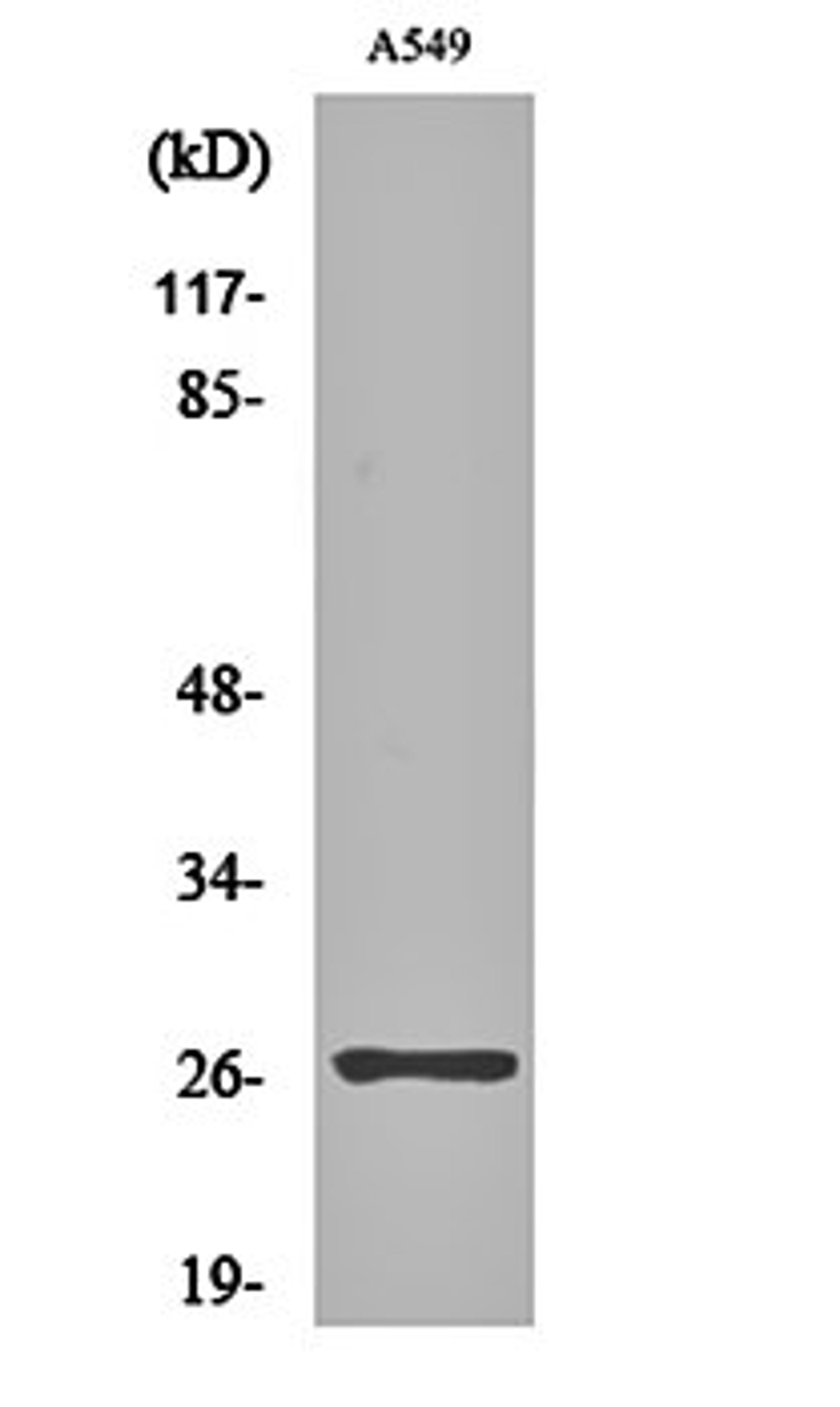 Western blot analysis of A549 cell lysates using NET-5 antibody