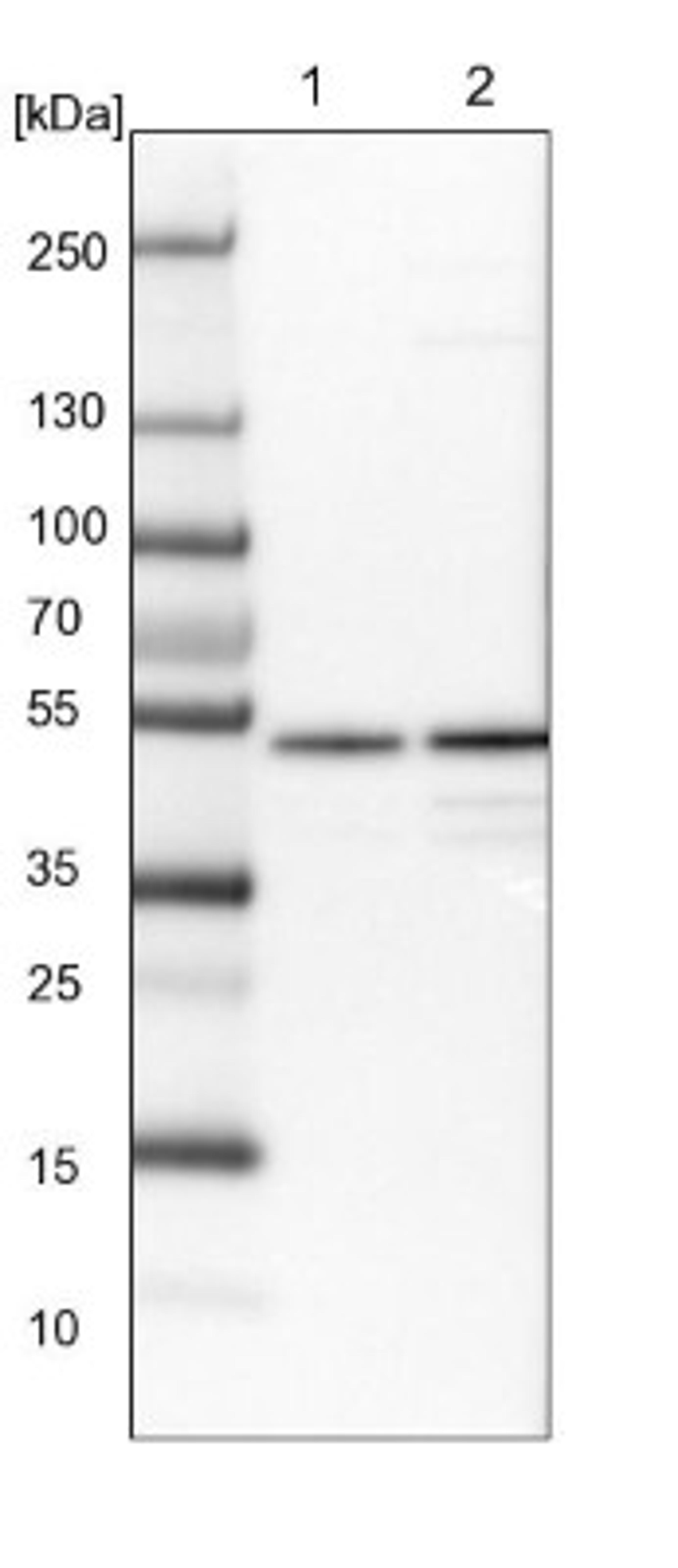 Western Blot: CCDC16 Antibody [NBP1-88165] - Lane 1: NIH-3T3 cell lysate (Mouse embryonic fibroblast cells)<br/>Lane 2: NBT-II cell lysate (Rat Wistar bladder tumour cells)