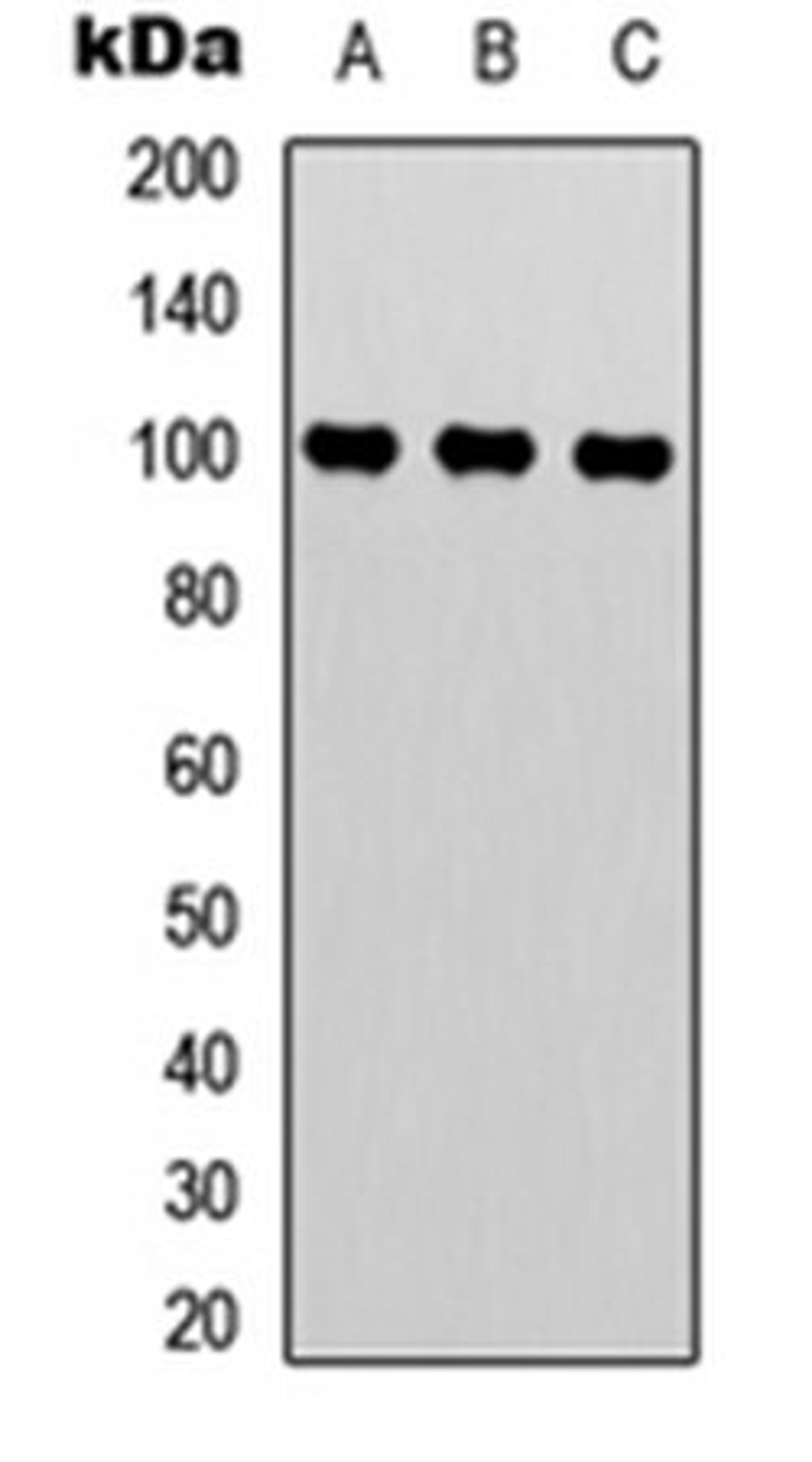 Western blot analysis of HepG2 (Lane 1), HEK293T (Lane 2), Hela (Lane 3) whole cell lysates using TRAP100 antibody