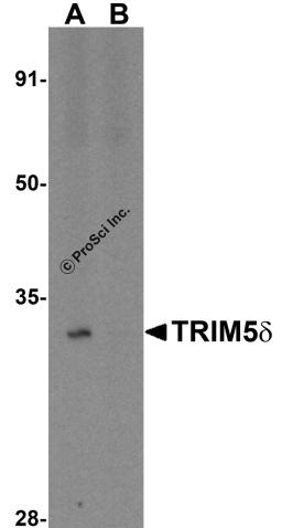 Western blot analysis of TRIM5 delta in human kidney tissue lysate with TRIM5 delta antibody at 1 μg/ml in (A) the absence and (B) the presence of blocking peptide.