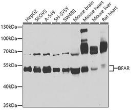 Western blot - BFAR antibody (A8308)