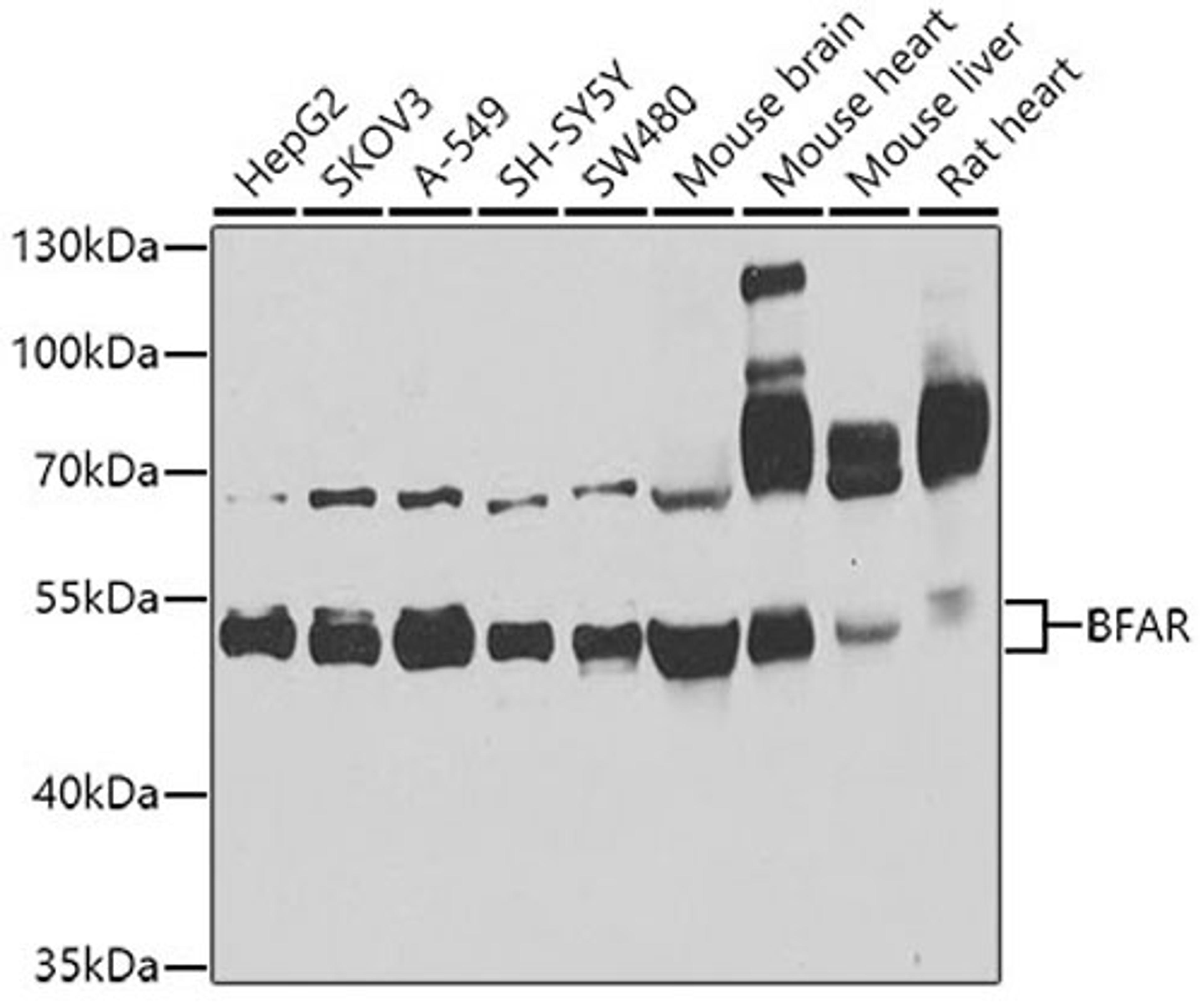 Western blot - BFAR antibody (A8308)