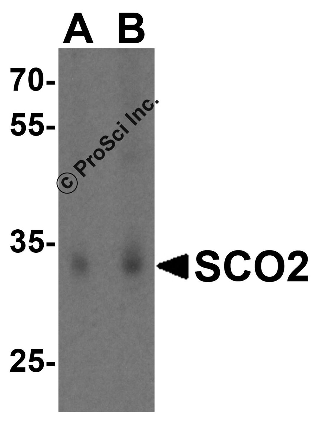 Western blot analysis of SCO2 in HL60 cell lysate lysate with SCO2 antibody at (A) 1 and (B) 2 μg/mL.