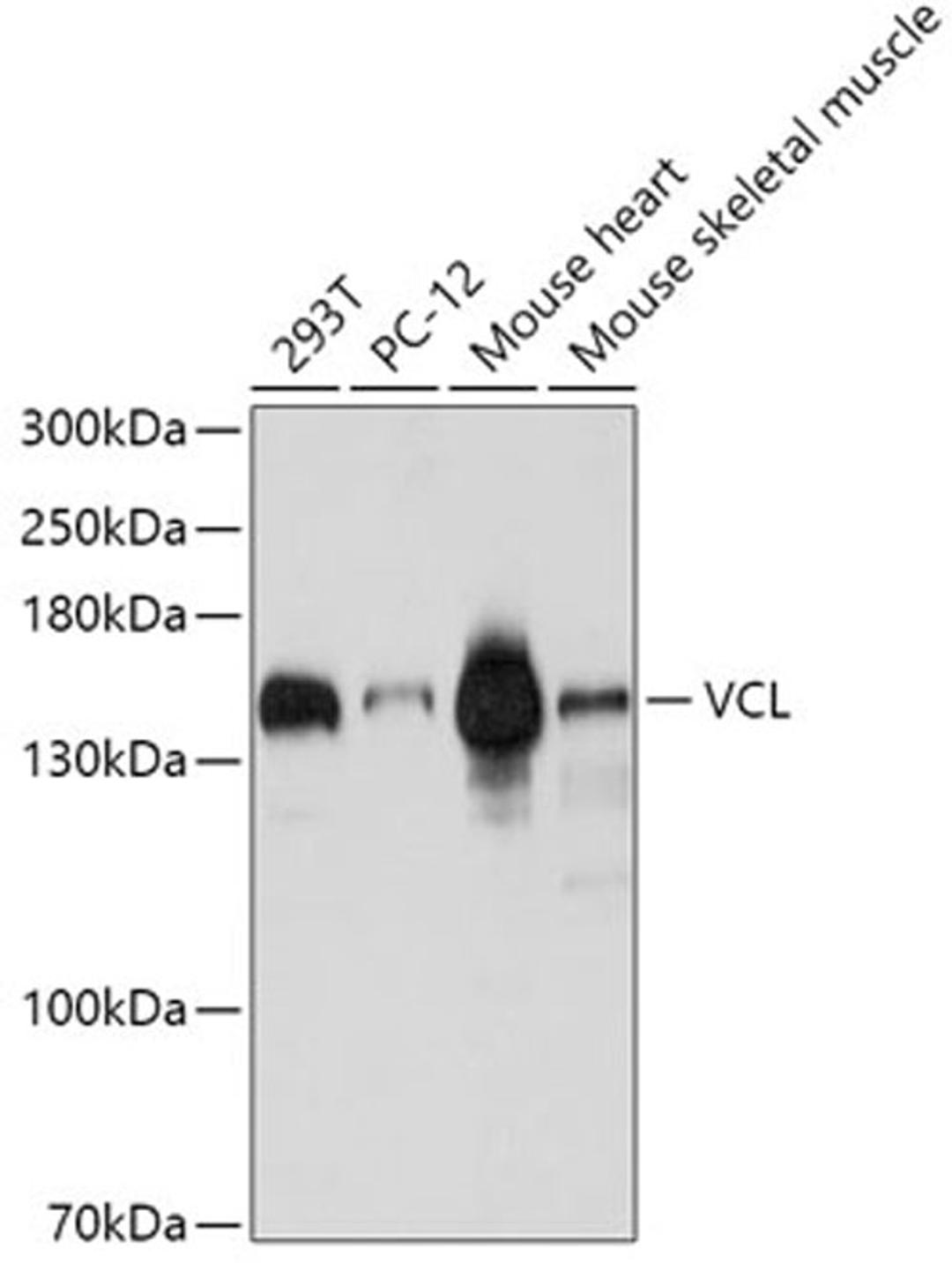 Western blot - VCL antibody (A1758)