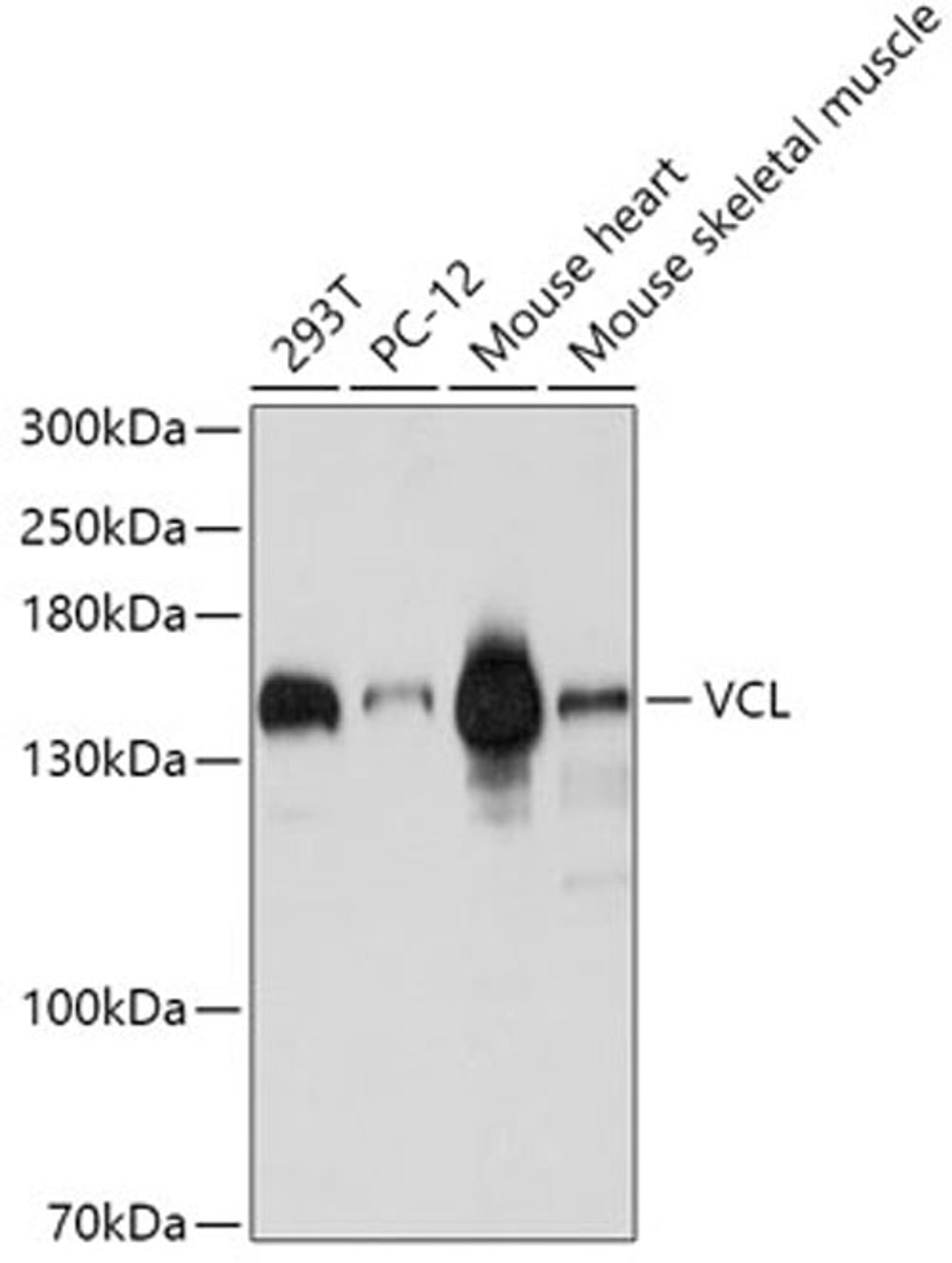 Western blot - VCL antibody (A1758)