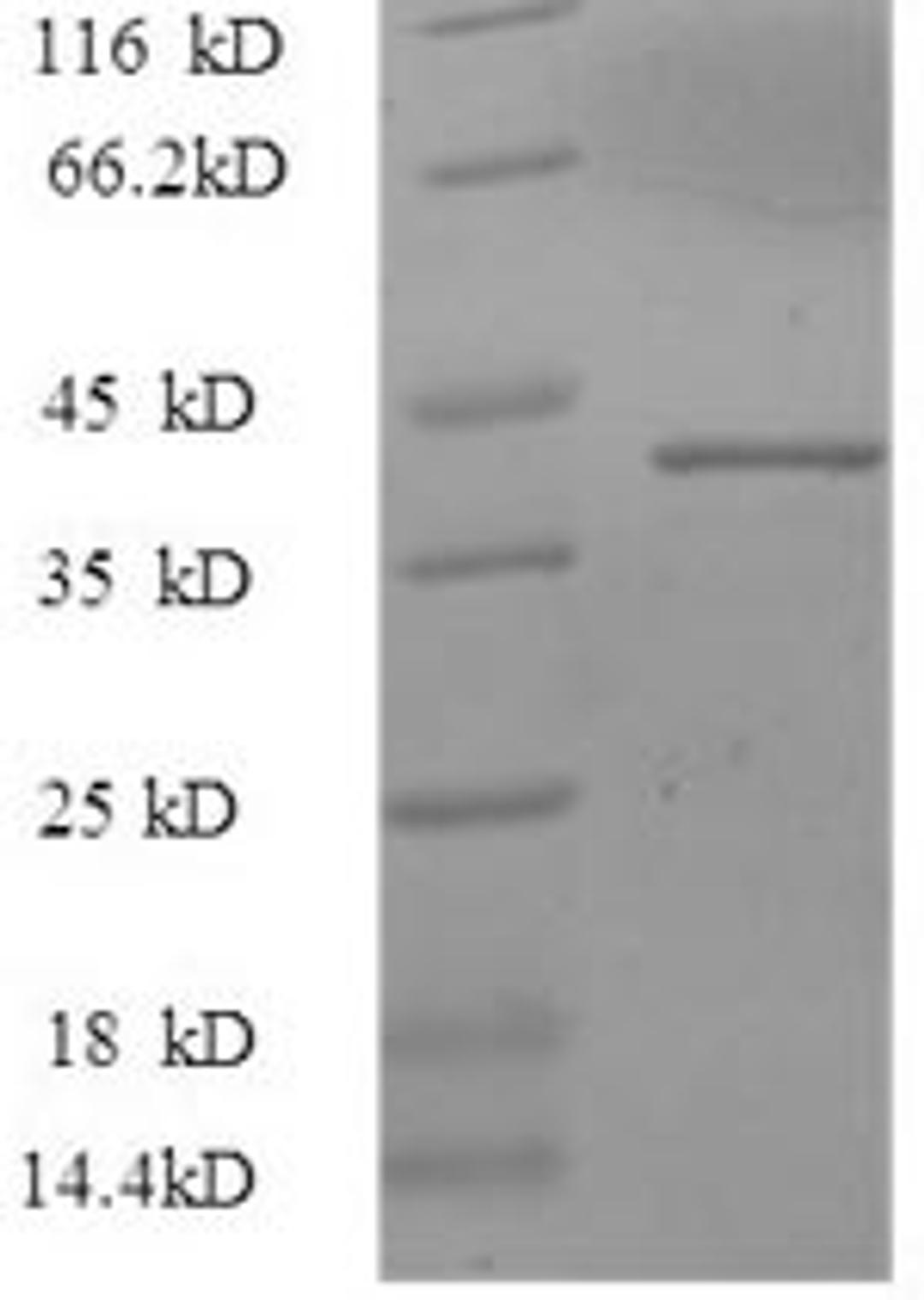 (Tris-Glycine gel) Discontinuous SDS-PAGE (reduced) with 5% enrichment gel and 15% separation gel.