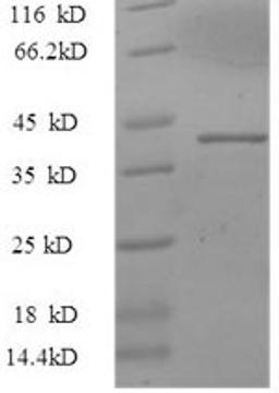 (Tris-Glycine gel) Discontinuous SDS-PAGE (reduced) with 5% enrichment gel and 15% separation gel.