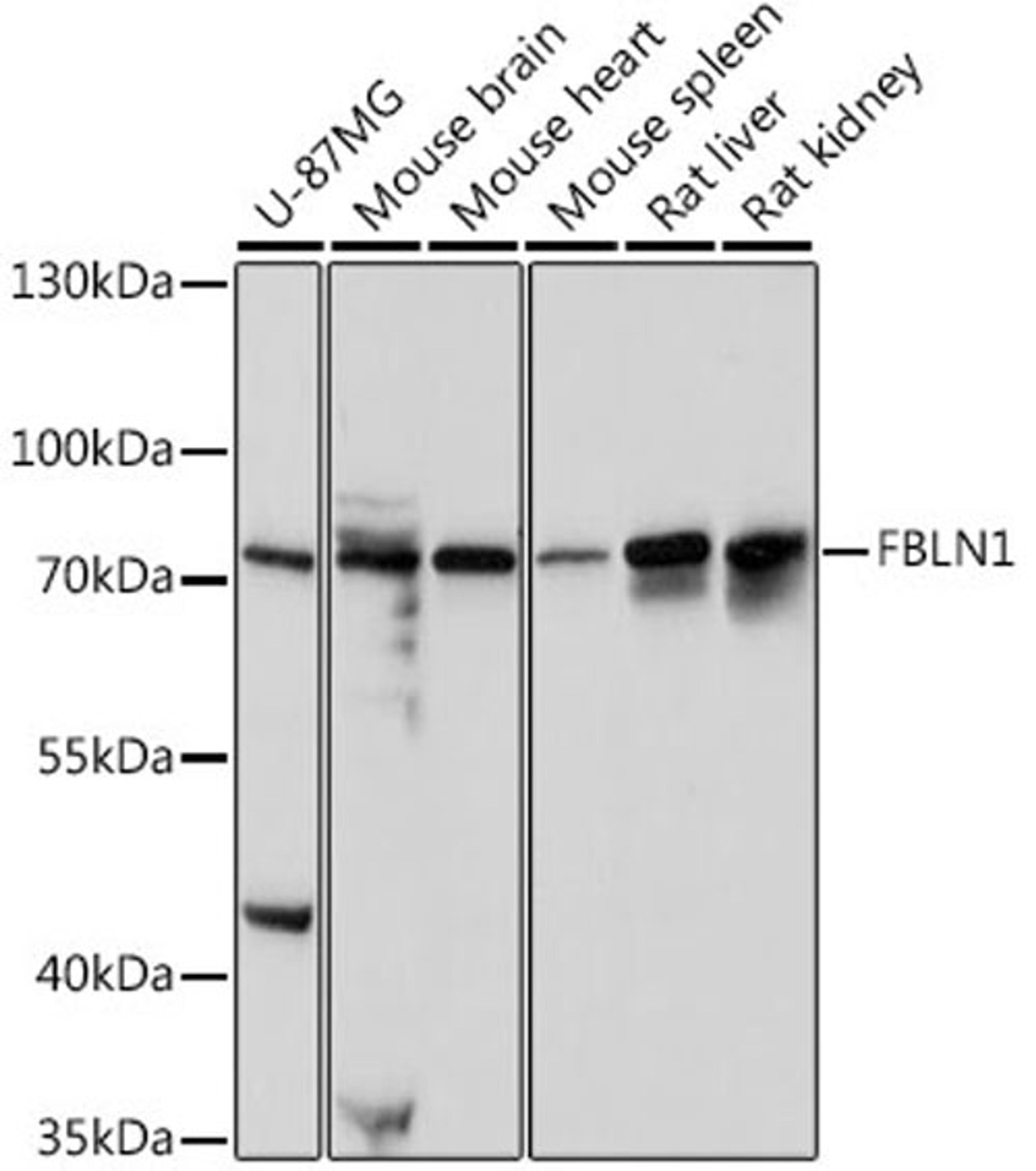 Western blot - FBLN1 antibody (A16046)