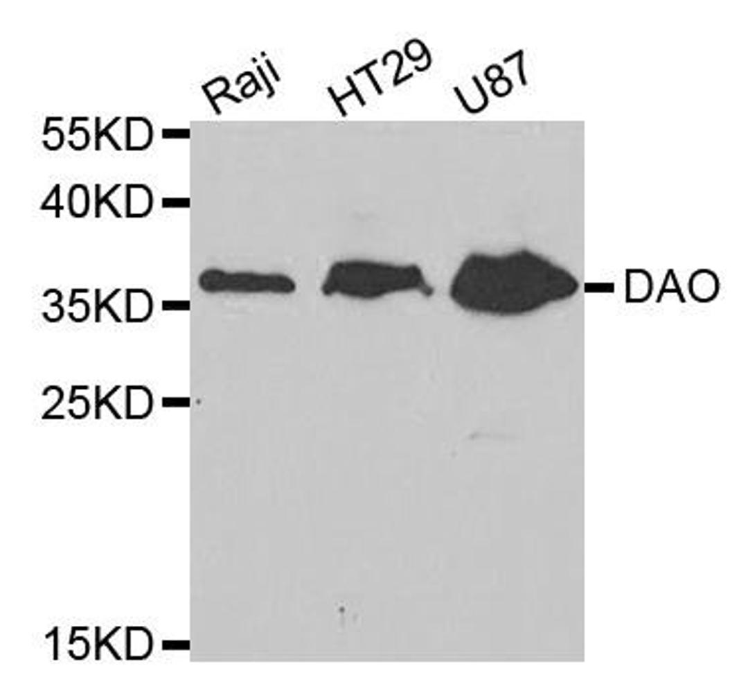 Western blot analysis of extracts of various cell lines using DAO antibody