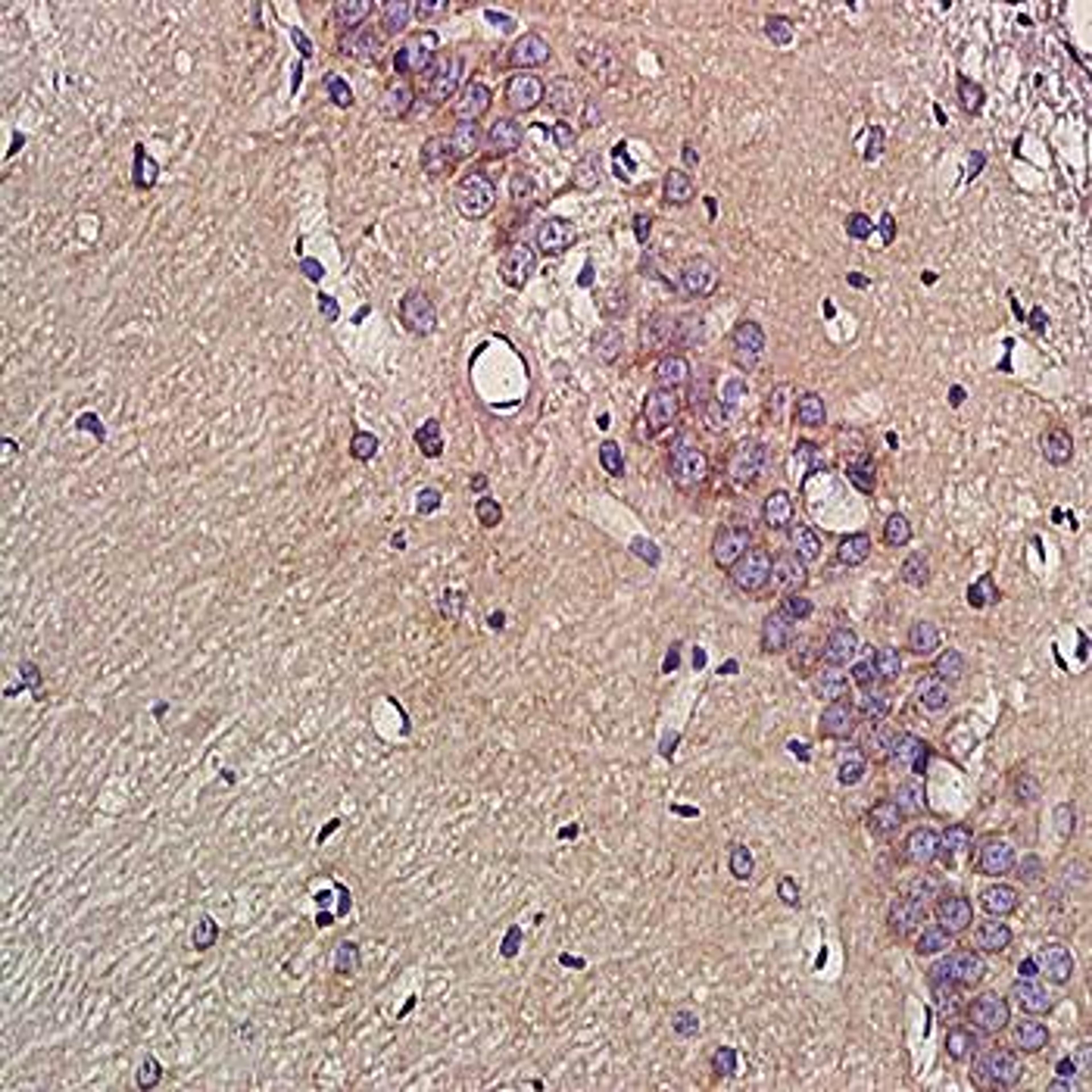 Immunohistochemical analysis of formalin-fixed and paraffin embedded rat brain tissue (dilution at:1:200) using EAAT2 antibody