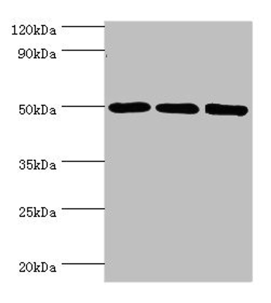 Western blot. All lanes: ZMYND10 antibody at 8ug/ml. Lane 1: A549 whole cell lysate. Lane 2: Mouse kidney tissue. Lane 3: Mouse skeletal muscle tissue. Secondary. Goat polyclonal to rabbit IgG at 1/10000 dilution. Predicted band size: 51, 50 kDa. Observed band size: 51 kDa.