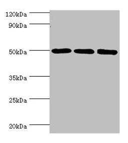 Western blot. All lanes: ZMYND10 antibody at 8ug/ml. Lane 1: A549 whole cell lysate. Lane 2: Mouse kidney tissue. Lane 3: Mouse skeletal muscle tissue. Secondary. Goat polyclonal to rabbit IgG at 1/10000 dilution. Predicted band size: 51, 50 kDa. Observed band size: 51 kDa.