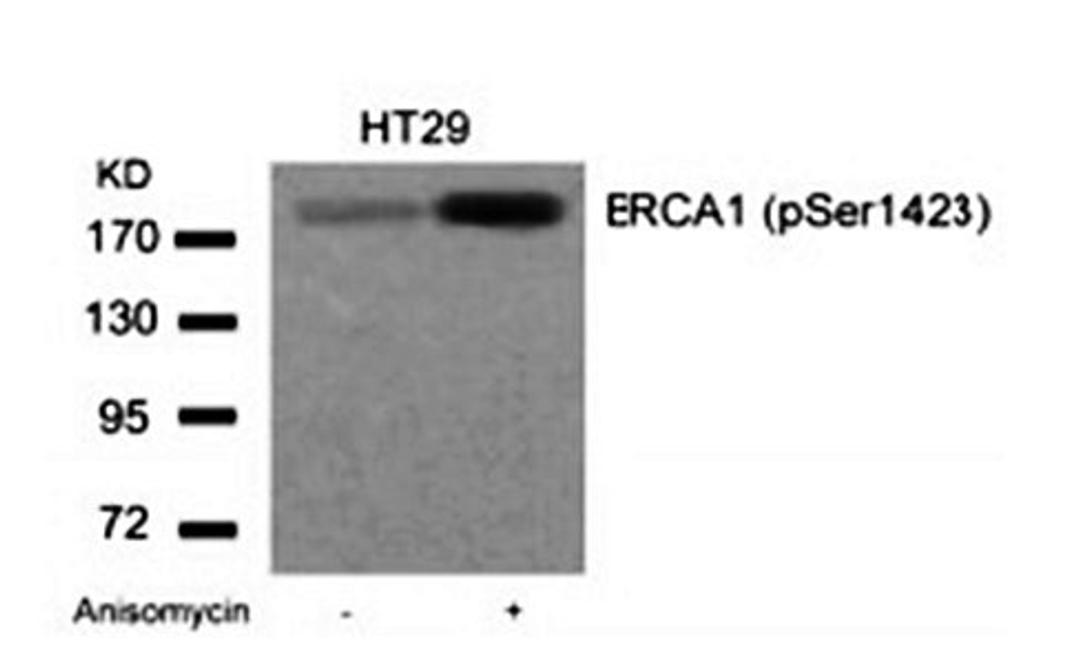 Western blot analysis of extracts from HT29 cells untreted or treated with Anisomycin using BRACA1(Phospho-Ser1423) antibody