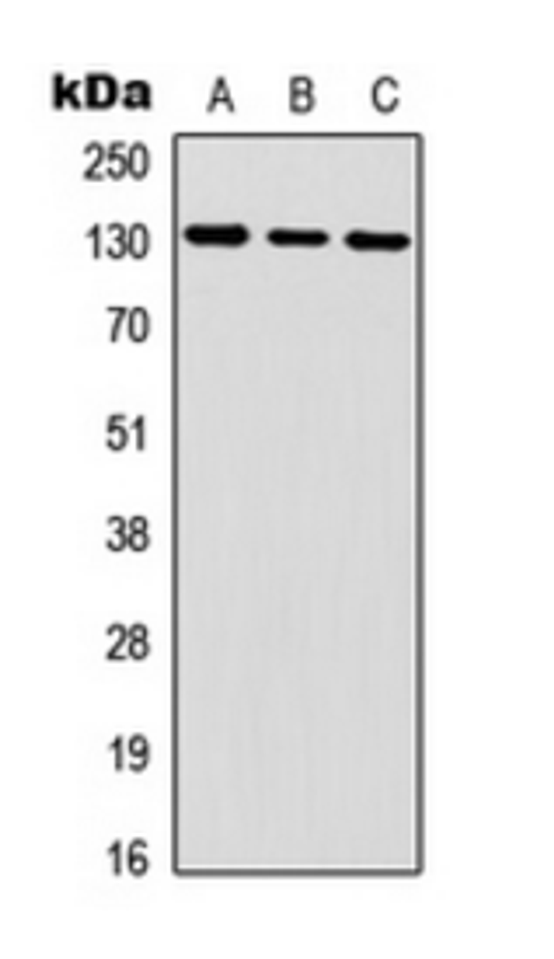 Western blot analysis of HEK293T (Lane 1), mouse brain (Lane 2) whole cell lysates using IL6ST antibody