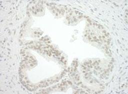 Detection of human CBX7 by immunohistochemistry.