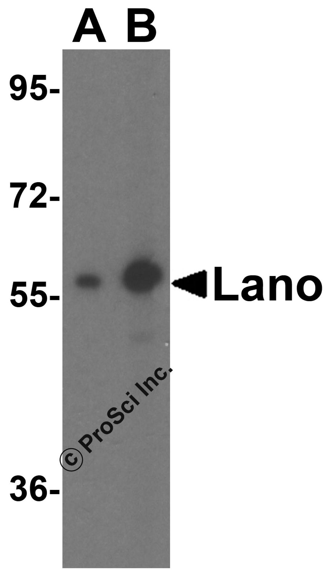 Western blot analysis of Lano expression in A431 cell lysate with Lano antibody at (A) 1 and (B) 2 μg/ml.