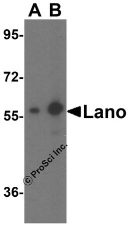 Western blot analysis of Lano expression in A431 cell lysate with Lano antibody at (A) 1 and (B) 2 μg/ml.