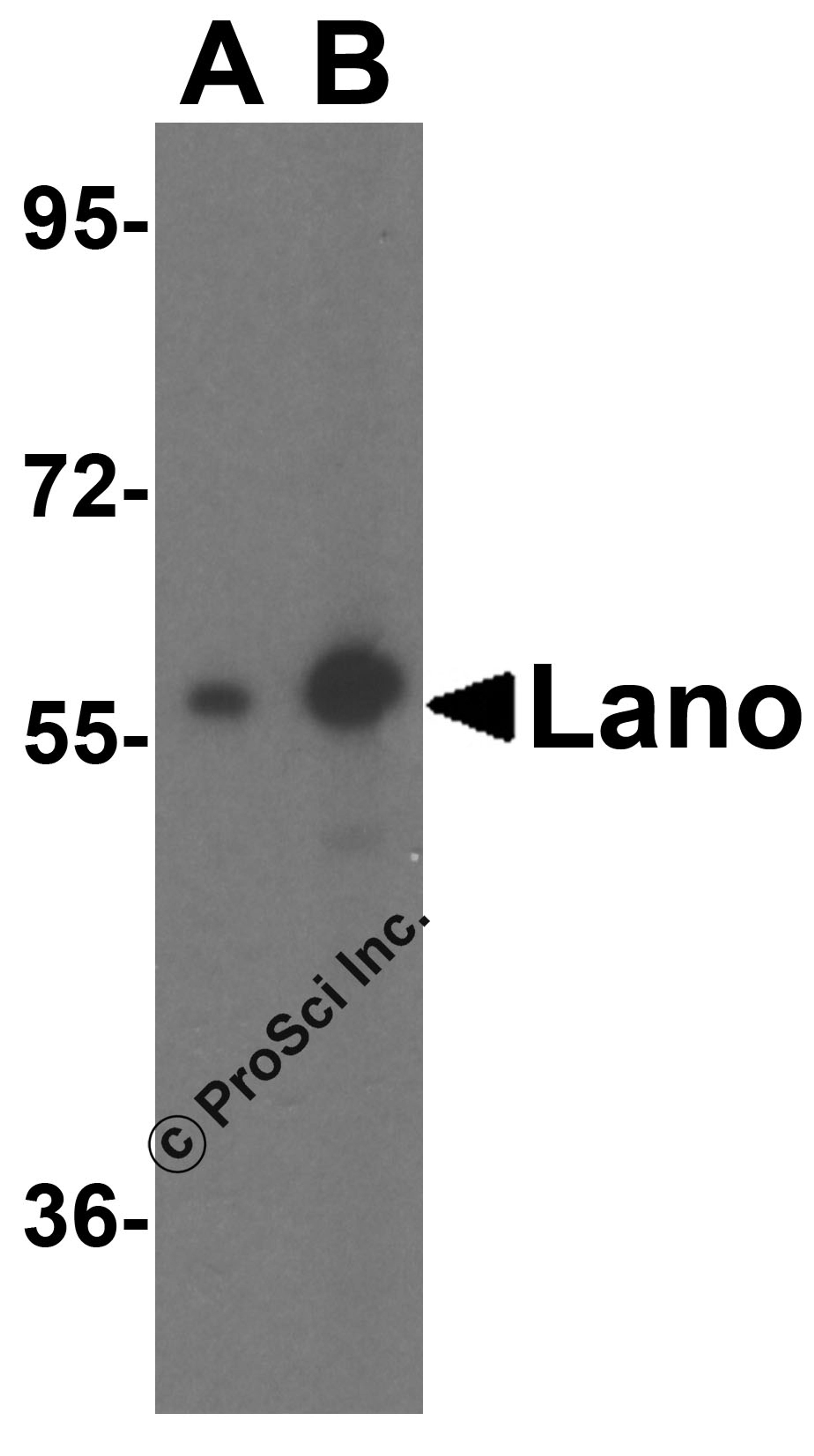 Western blot analysis of Lano expression in A431 cell lysate with Lano antibody at (A) 1 and (B) 2 μg/ml.