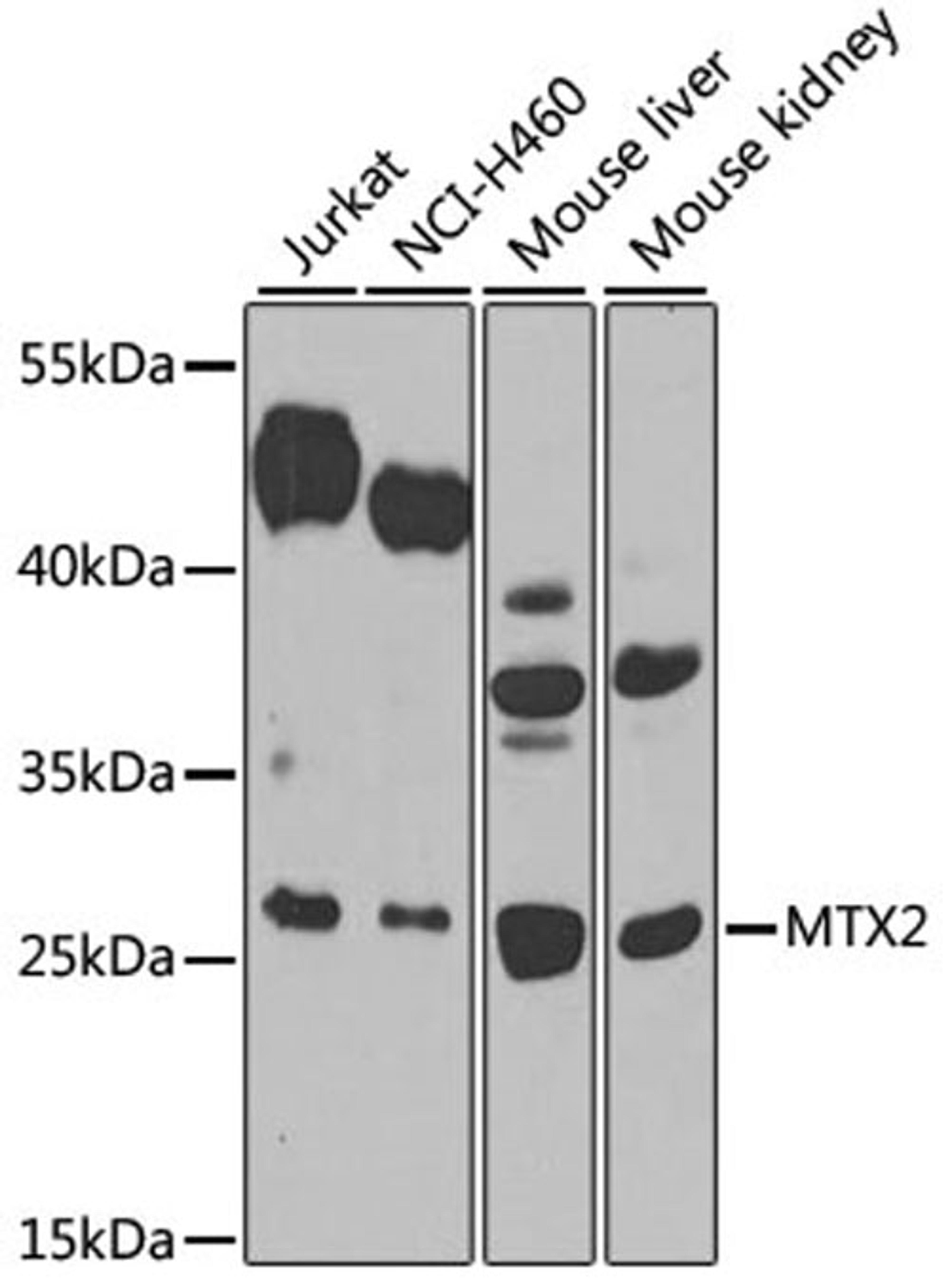 Western blot - MTX2 antibody (A7958)