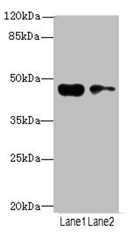 Western blot. All lanes: CCNE2antibody at 3.25ug/ml. Lane 1: Jurkat whole cell lysate. Lane 2: Hela whole cell lysate. Secondary. Goat polyclonal to rabbit IgG at 1/10000 dilution. Predicted band size: 47, 42 kDa. Observed band size: 47 kDa.