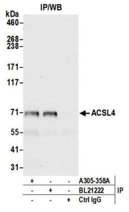 Detection of human ACSL4 by western blot of immunoprecipitates.