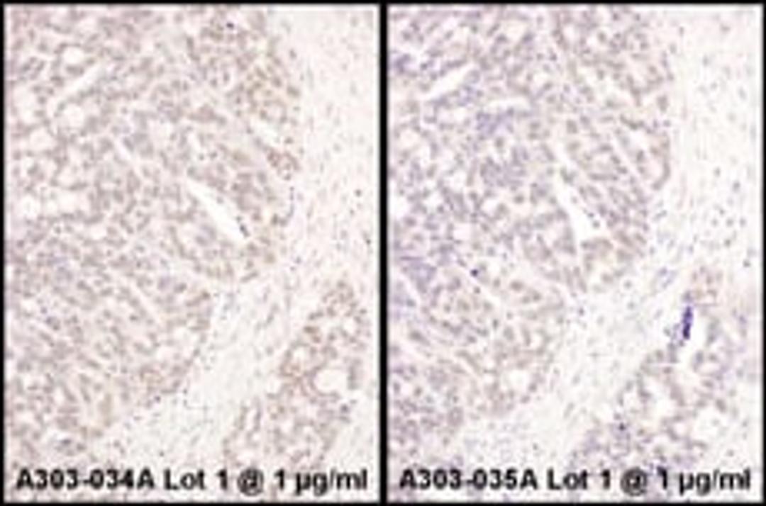 Detection of human ATF1 by immunohistochemistry.