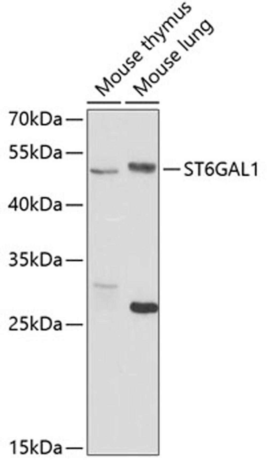 Western blot - ST6GAL1 antibody (A5754)