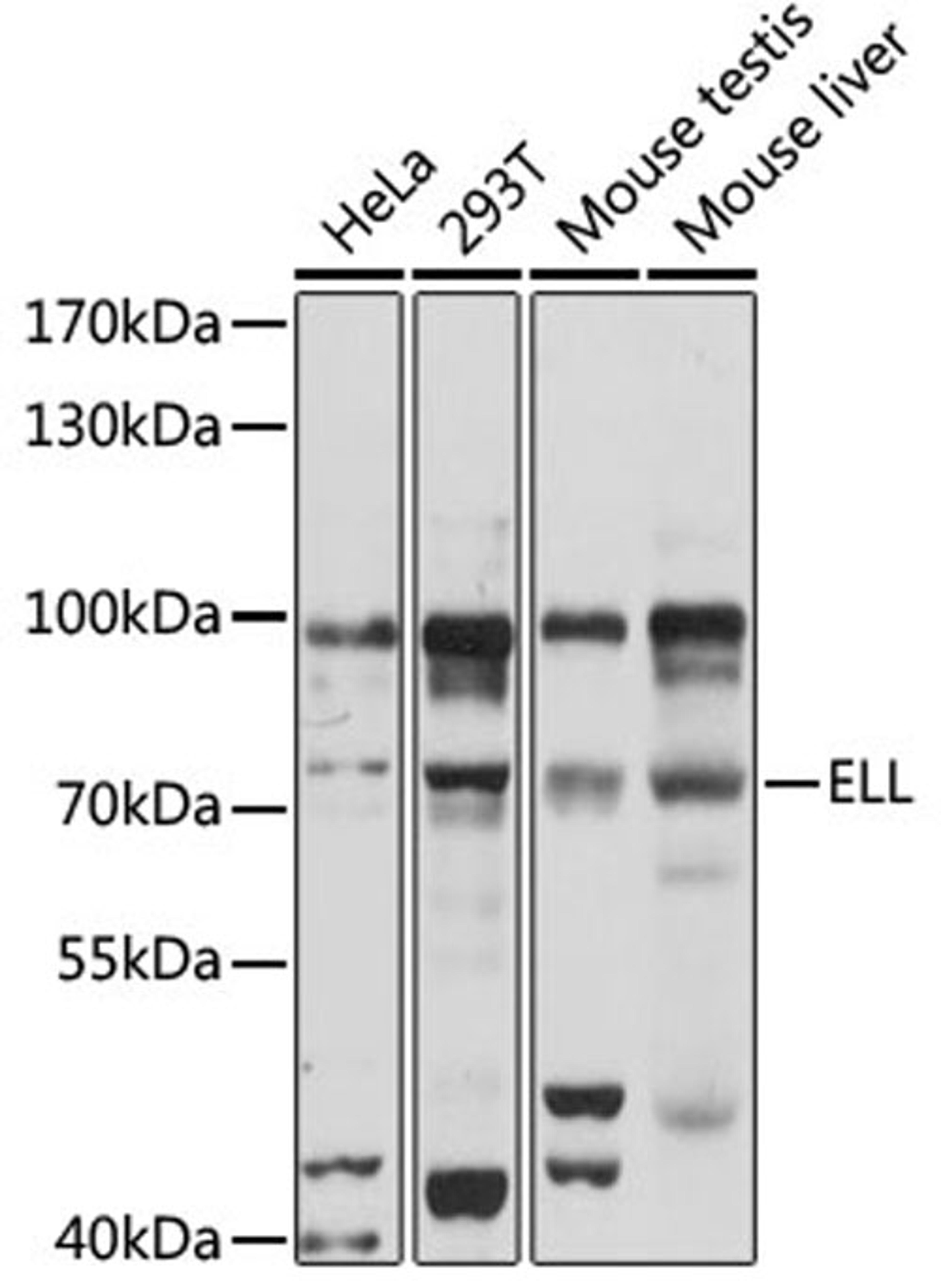 Western blot - ELL antibody (A16449)