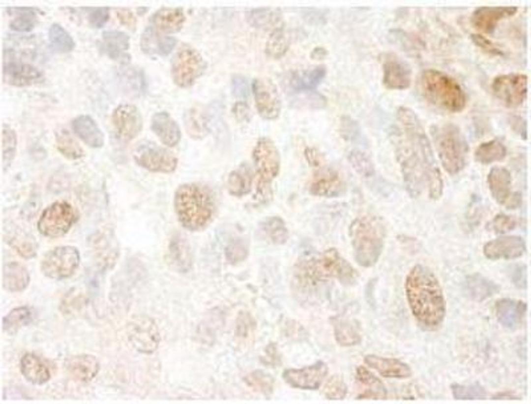 Immunohistochemistry-Frozen: PPIG Antibody [NBP1-19117] - FFPE section of mouse renal cell carcinoma.  Affinity purified rabbit anti-SRcyp used at a dilution of 1:250. Detection: DAB staining using Immunohistochemistry Accessory Kit