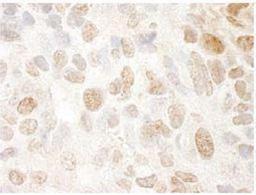 Immunohistochemistry-Frozen: PPIG Antibody [NBP1-19117] - FFPE section of mouse renal cell carcinoma.  Affinity purified rabbit anti-SRcyp used at a dilution of 1:250. Detection: DAB staining using Immunohistochemistry Accessory Kit