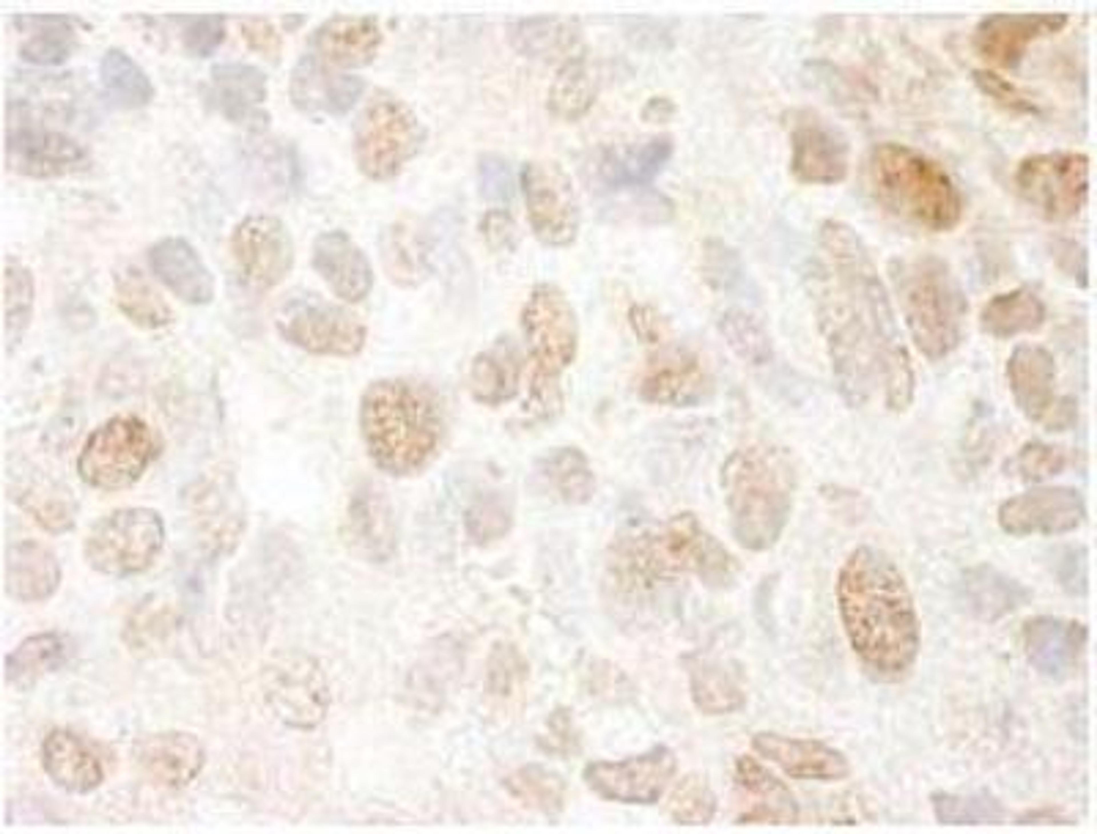 Immunohistochemistry-Frozen: PPIG Antibody [NBP1-19117] - FFPE section of mouse renal cell carcinoma.  Affinity purified rabbit anti-SRcyp used at a dilution of 1:250. Detection: DAB staining using Immunohistochemistry Accessory Kit