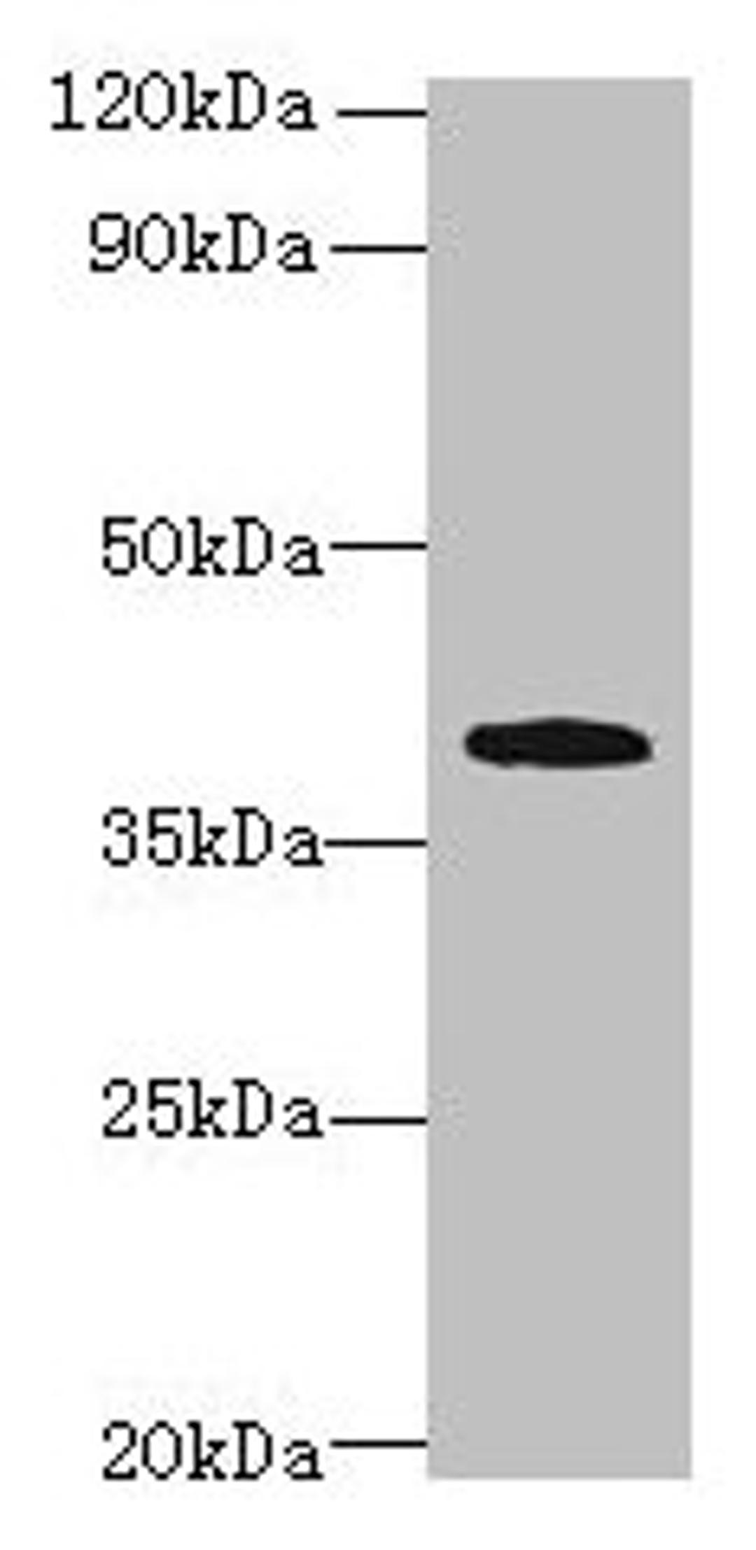 Western blot. All lanes: PRPSAP1 antibody at 4µg/ml + Hela whole cell lysate. Secondary. Goat polyclonal to rabbit IgG at 1/10000 dilution. Predicted band size: 40, 43 kDa. Observed band size: 40 kDa