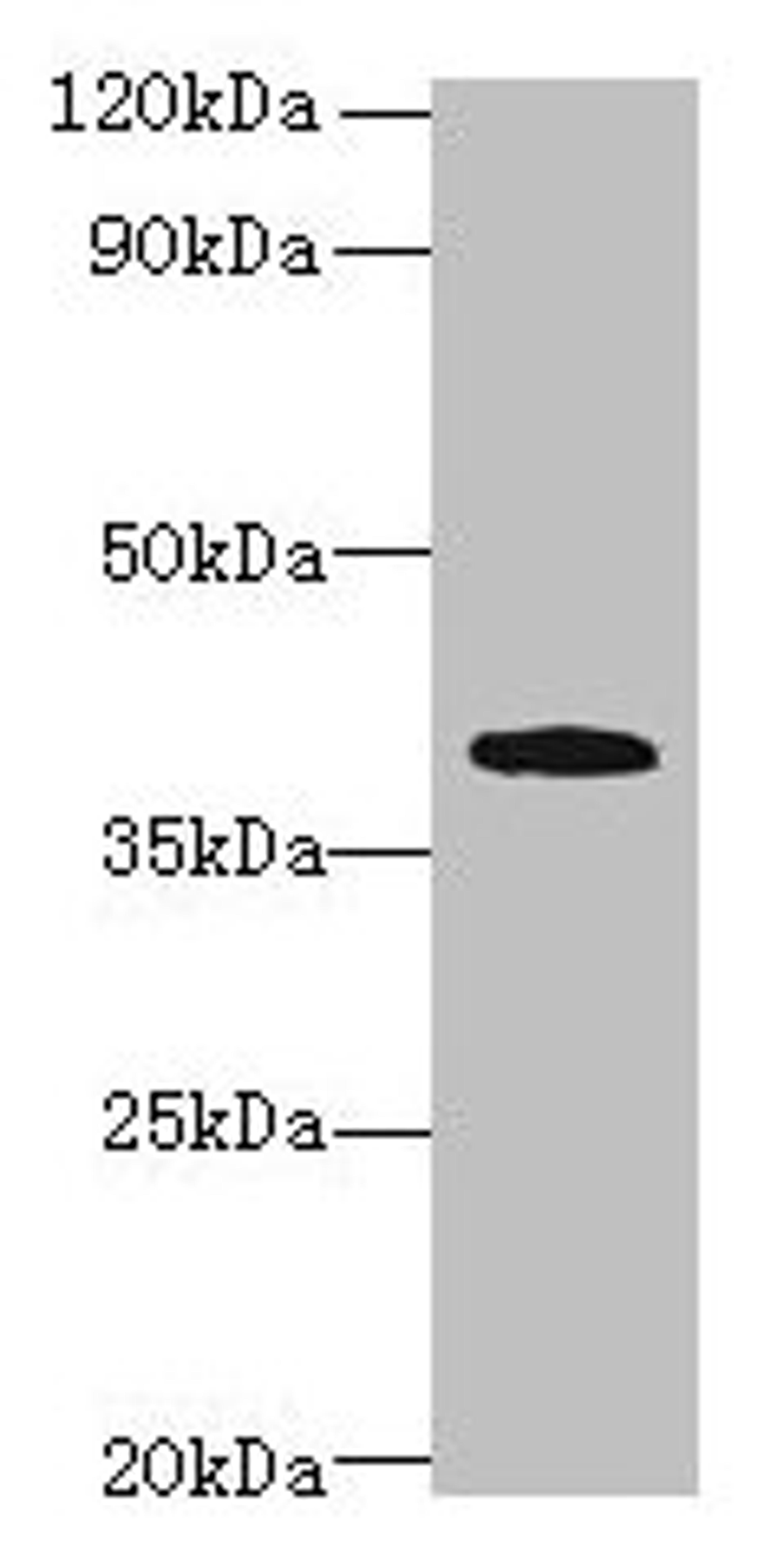 Western blot. All lanes: PRPSAP1 antibody at 4µg/ml + Hela whole cell lysate. Secondary. Goat polyclonal to rabbit IgG at 1/10000 dilution. Predicted band size: 40, 43 kDa. Observed band size: 40 kDa