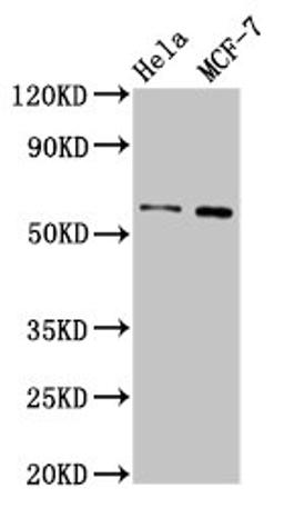 Western Blot. Positive WB detected in: Hela whole cell lysate, MCF-7 whole cell lysate. All lanes: MMP28 antibody at 3.2µg/ml. Secondary. Goat polyclonal to rabbit IgG at 1/50000 dilution. Predicted band size: 59, 15 kDa. Observed band size: 59 kDa