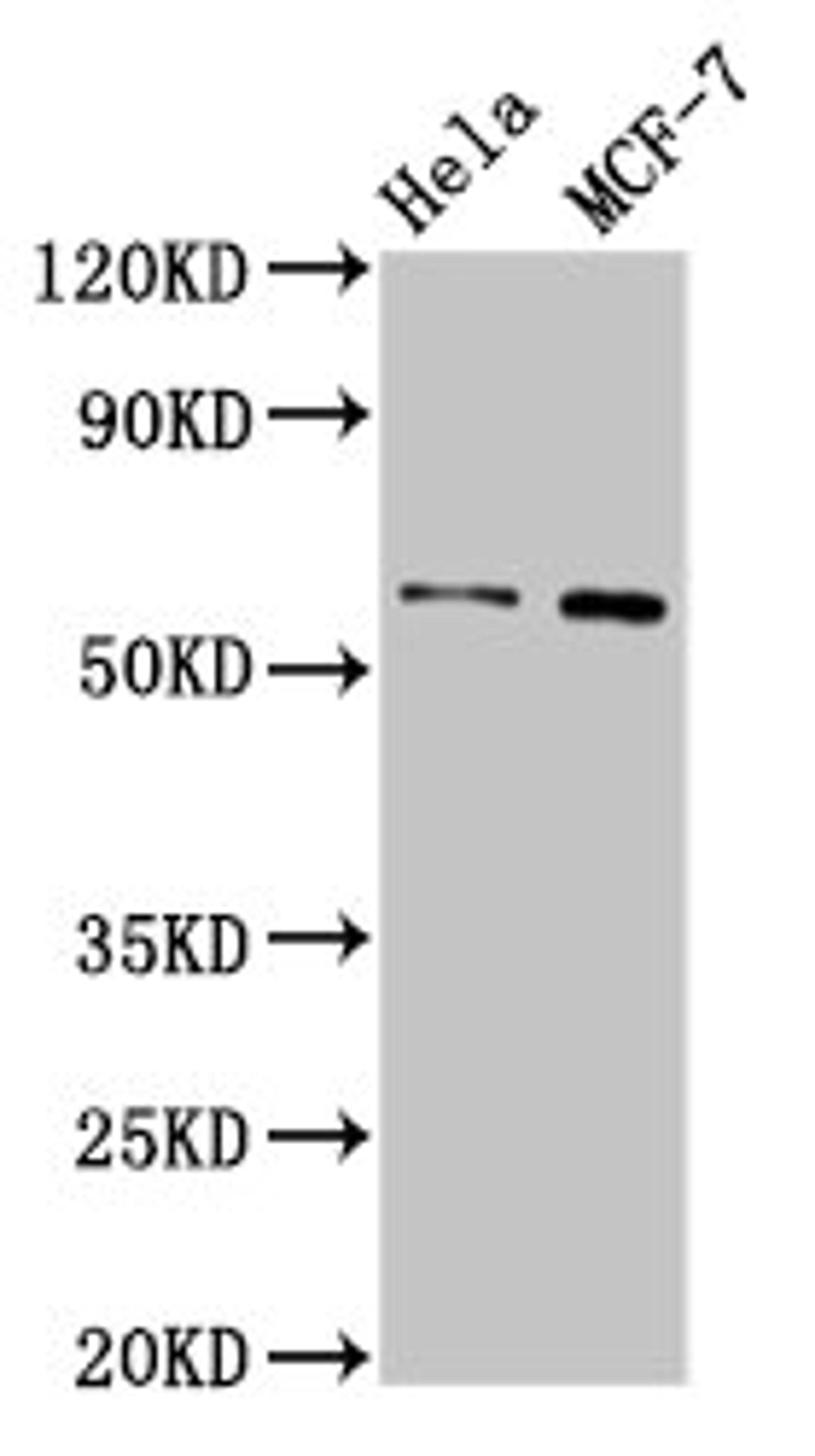 Western Blot. Positive WB detected in: Hela whole cell lysate, MCF-7 whole cell lysate. All lanes: MMP28 antibody at 3.2µg/ml. Secondary. Goat polyclonal to rabbit IgG at 1/50000 dilution. Predicted band size: 59, 15 kDa. Observed band size: 59 kDa