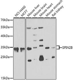 Western blot - SPIN2B antibody (A7407)