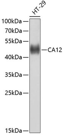 Western blot - CA12 antibody (A10187)