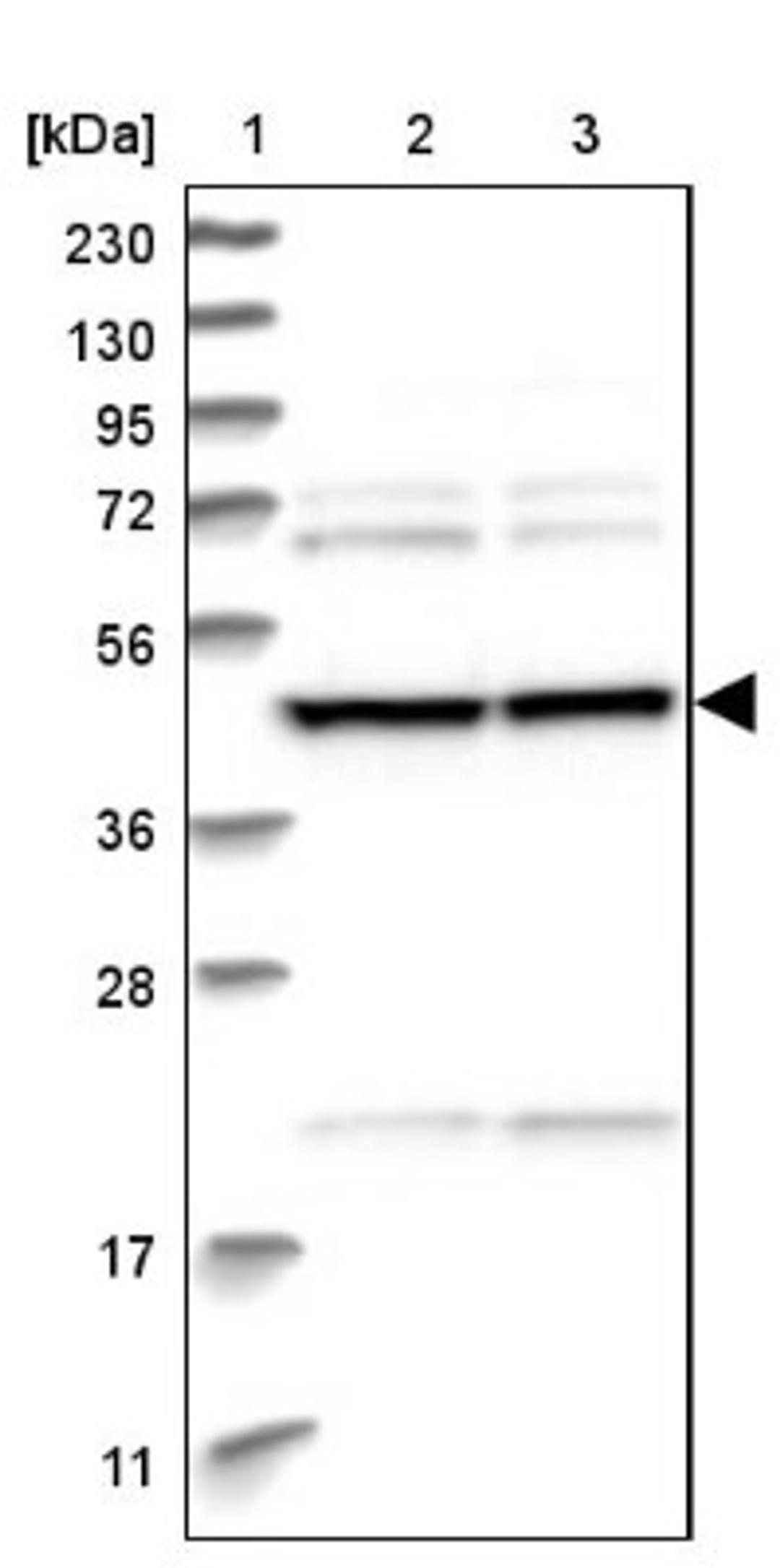 Western Blot: BROX Antibody [NBP1-90706] - Lane 1: Marker [kDa] 230, 130, 95, 72, 56, 36, 28, 17, 11<br/>Lane 2: Human cell line RT-4<br/>Lane 3: Human cell line U-251MG sp