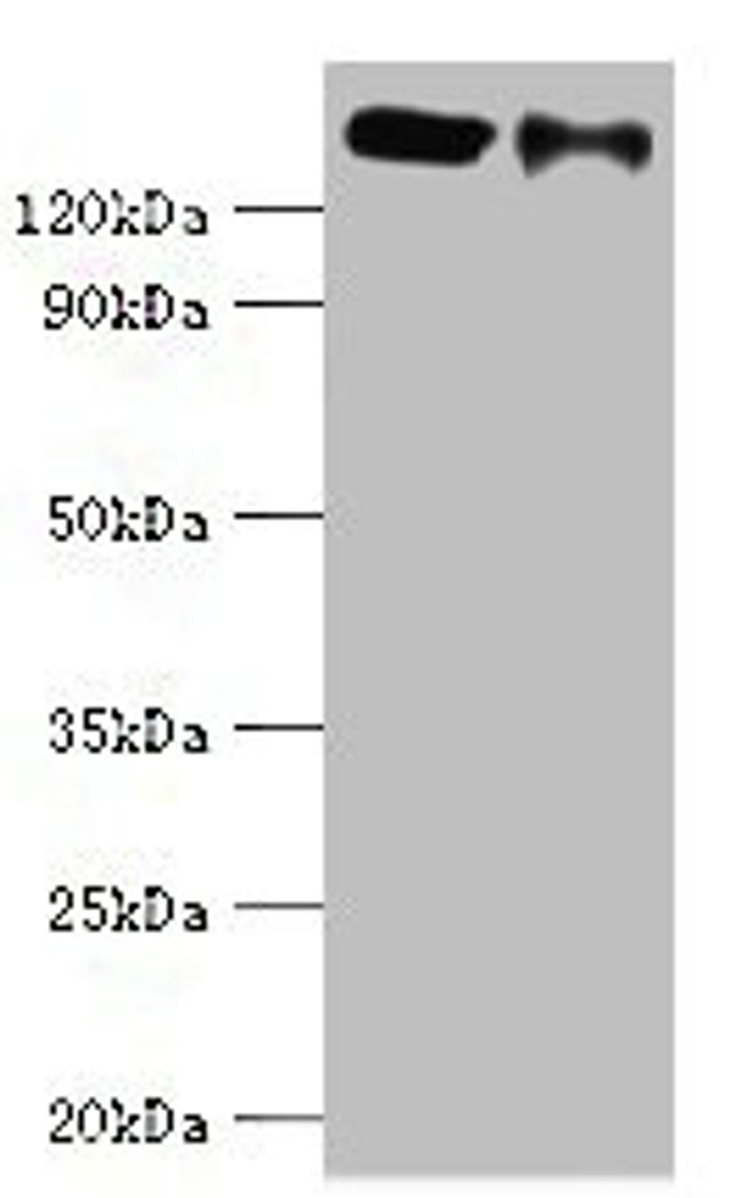 Western blot. All lanes: CCAR1 antibody at 8ug/ml. Lane 1: Hela whole cell lysate. Lane 2: PC-3 whole cell lysate. Secondary. Goat polyclonal to rabbit IgG at 1/10000 dilution. Predicted band size: 133, 132 kDa. Observed band size: 133 kDa. 