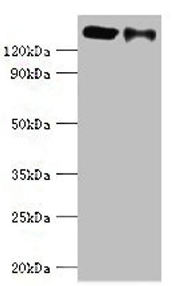 Western blot. All lanes: CCAR1 antibody at 8ug/ml. Lane 1: Hela whole cell lysate. Lane 2: PC-3 whole cell lysate. Secondary. Goat polyclonal to rabbit IgG at 1/10000 dilution. Predicted band size: 133, 132 kDa. Observed band size: 133 kDa. 