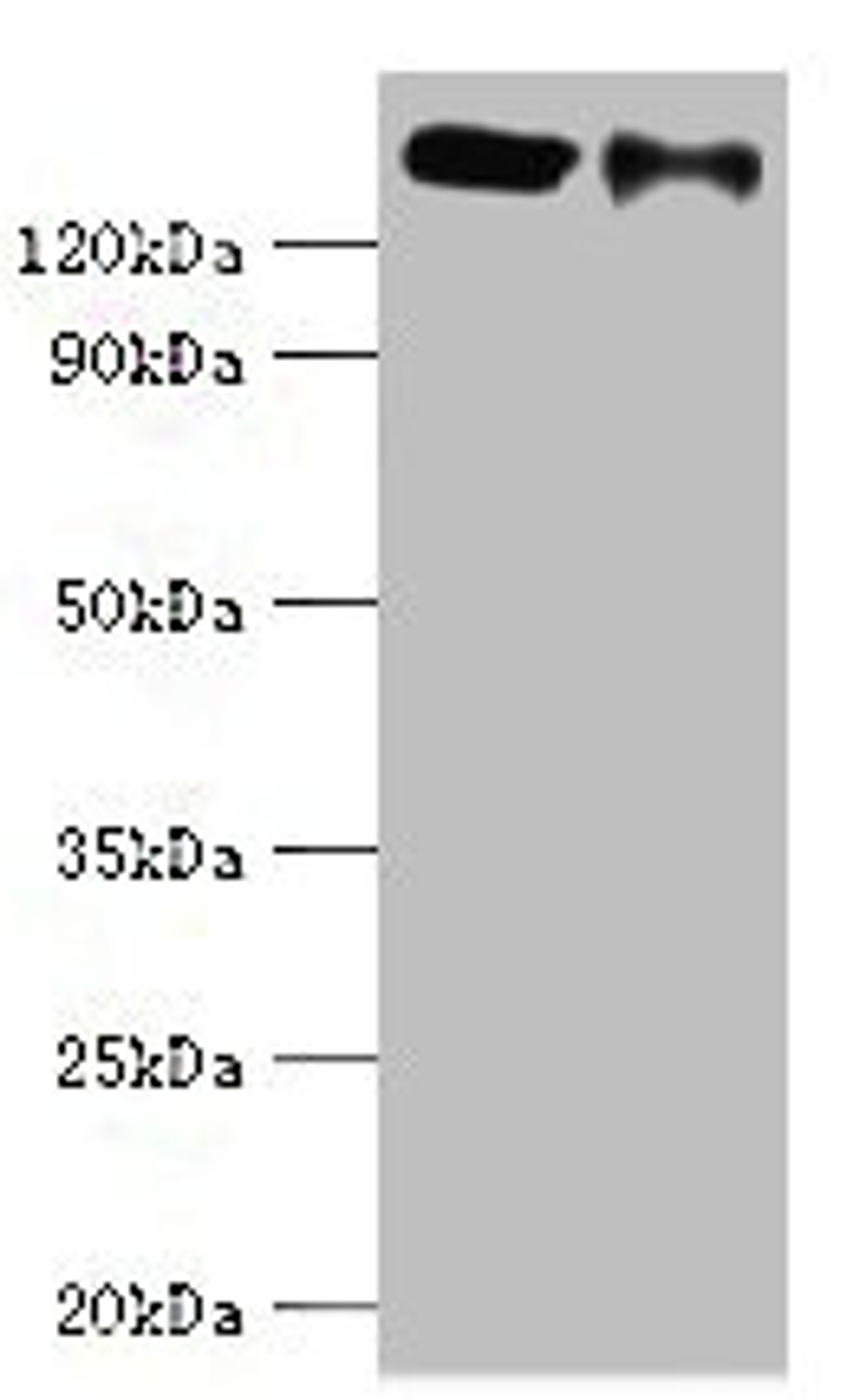 Western blot. All lanes: CCAR1 antibody at 8ug/ml. Lane 1: Hela whole cell lysate. Lane 2: PC-3 whole cell lysate. Secondary. Goat polyclonal to rabbit IgG at 1/10000 dilution. Predicted band size: 133, 132 kDa. Observed band size: 133 kDa. 