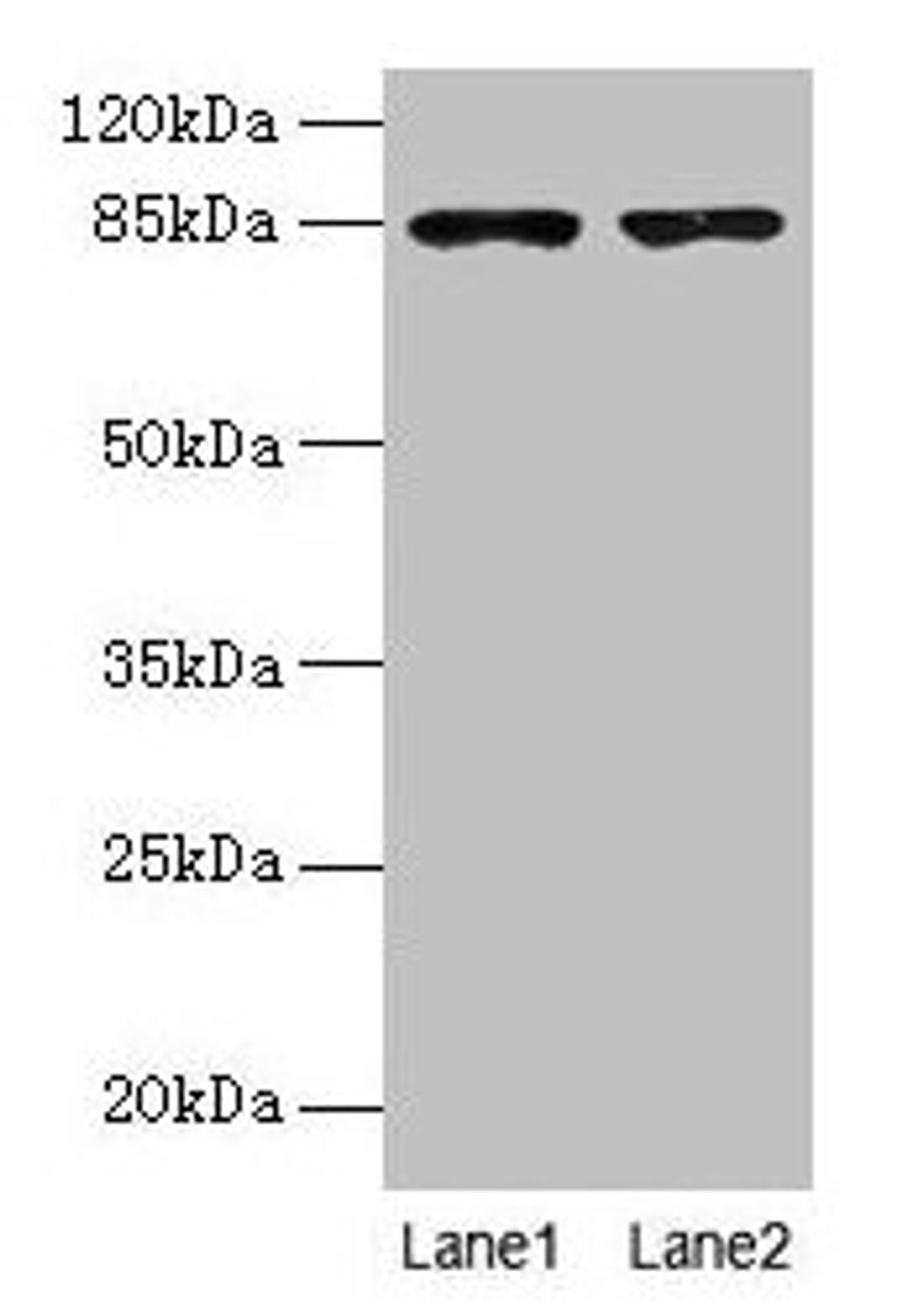Western blot. All lanes: FCHSD2 antibody at 12µg/ml. Lane 1: U251 whole cell lysate. Lane 2: A549 whole cell lysate. Secondary. Goat polyclonal to rabbit IgG at 1/10000 dilution. Predicted band size: 85, 78, 59 kDa. Observed band size: 85 kDa