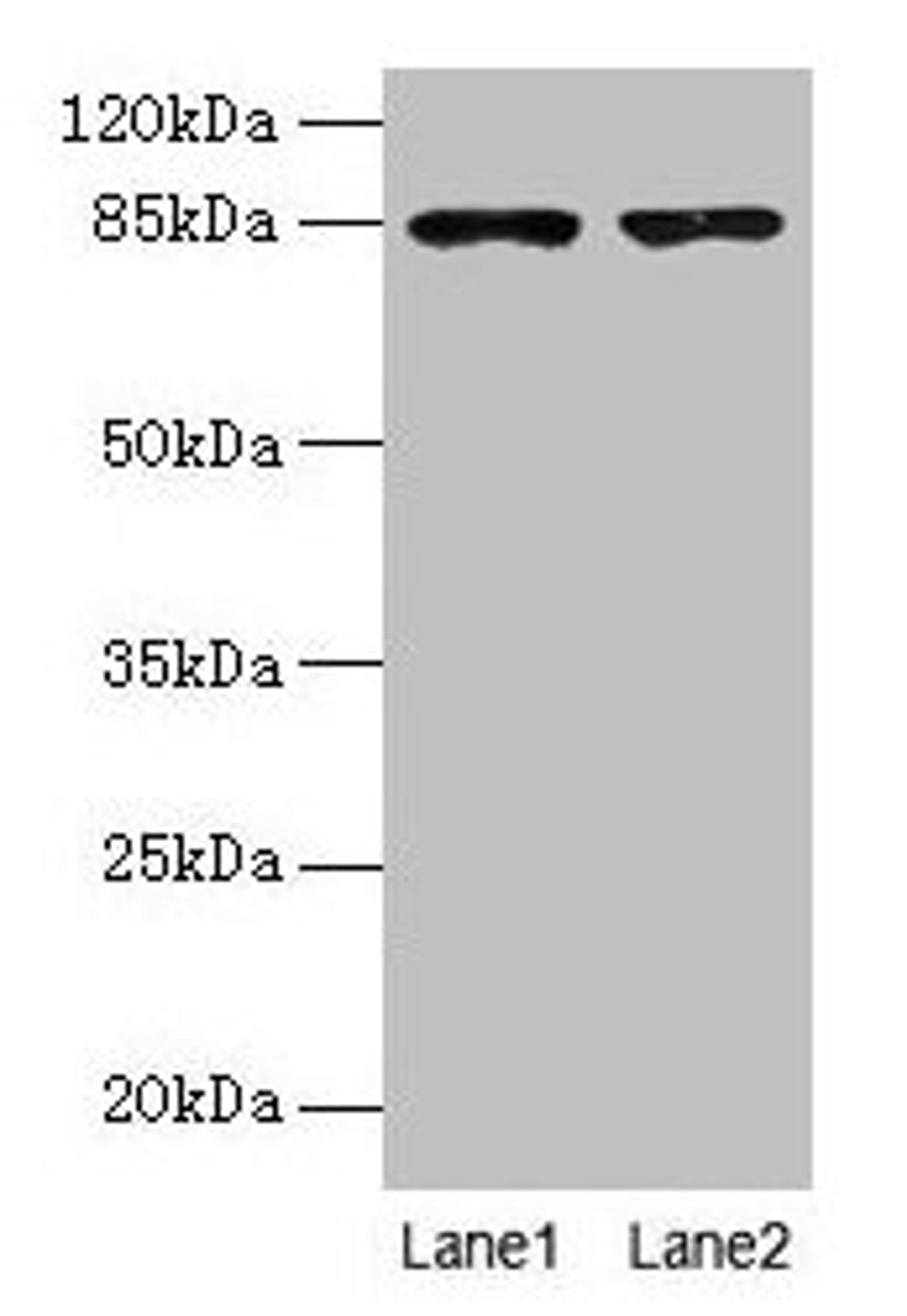 Western blot. All lanes: FCHSD2 antibody at 12µg/ml. Lane 1: U251 whole cell lysate. Lane 2: A549 whole cell lysate. Secondary. Goat polyclonal to rabbit IgG at 1/10000 dilution. Predicted band size: 85, 78, 59 kDa. Observed band size: 85 kDa