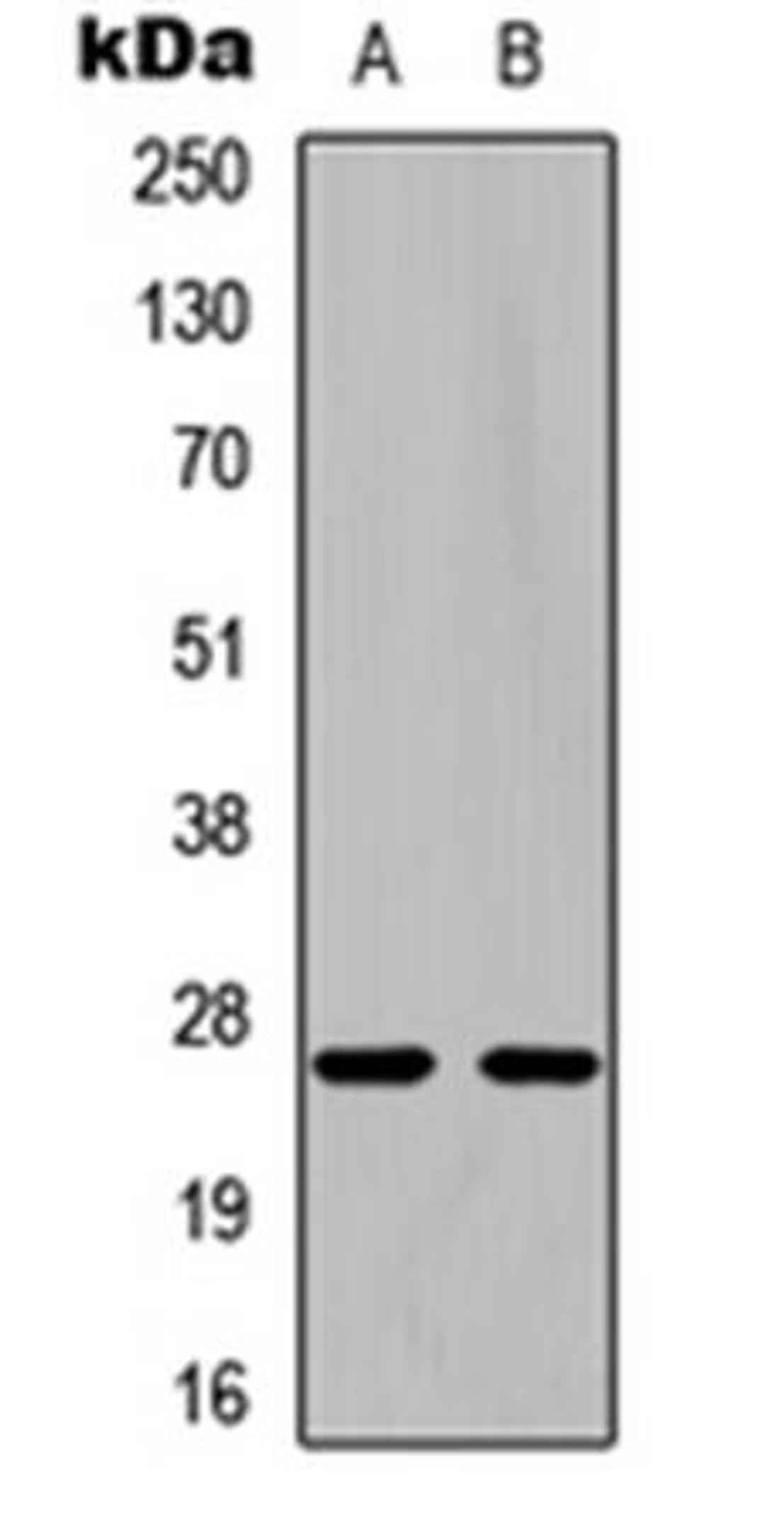 Western blot analysis of Jurkat (Lane1), NIH3T3 (Lane2) whole cell using pro-NGF beta antibody