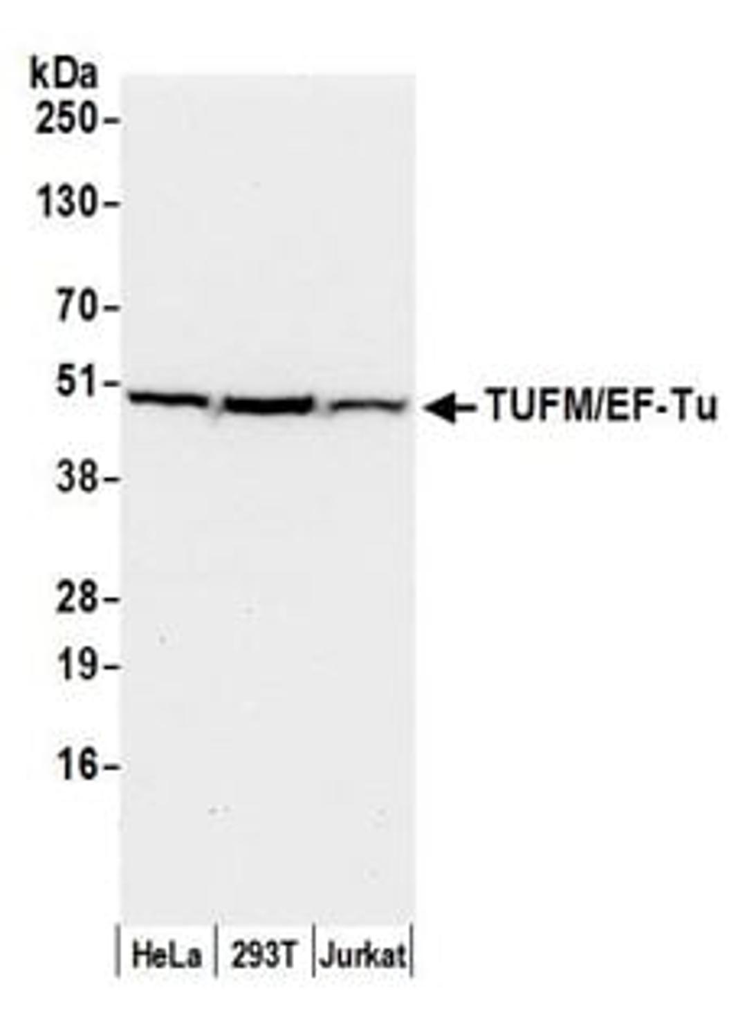 Detection of human TUFM/EF-Tu by western blot.