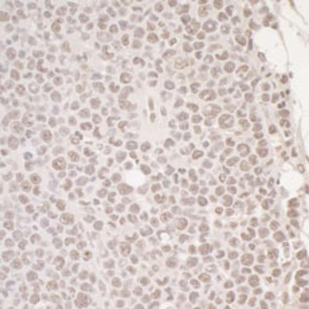 Detection of mouse OCT1 by immunohistochemistry.