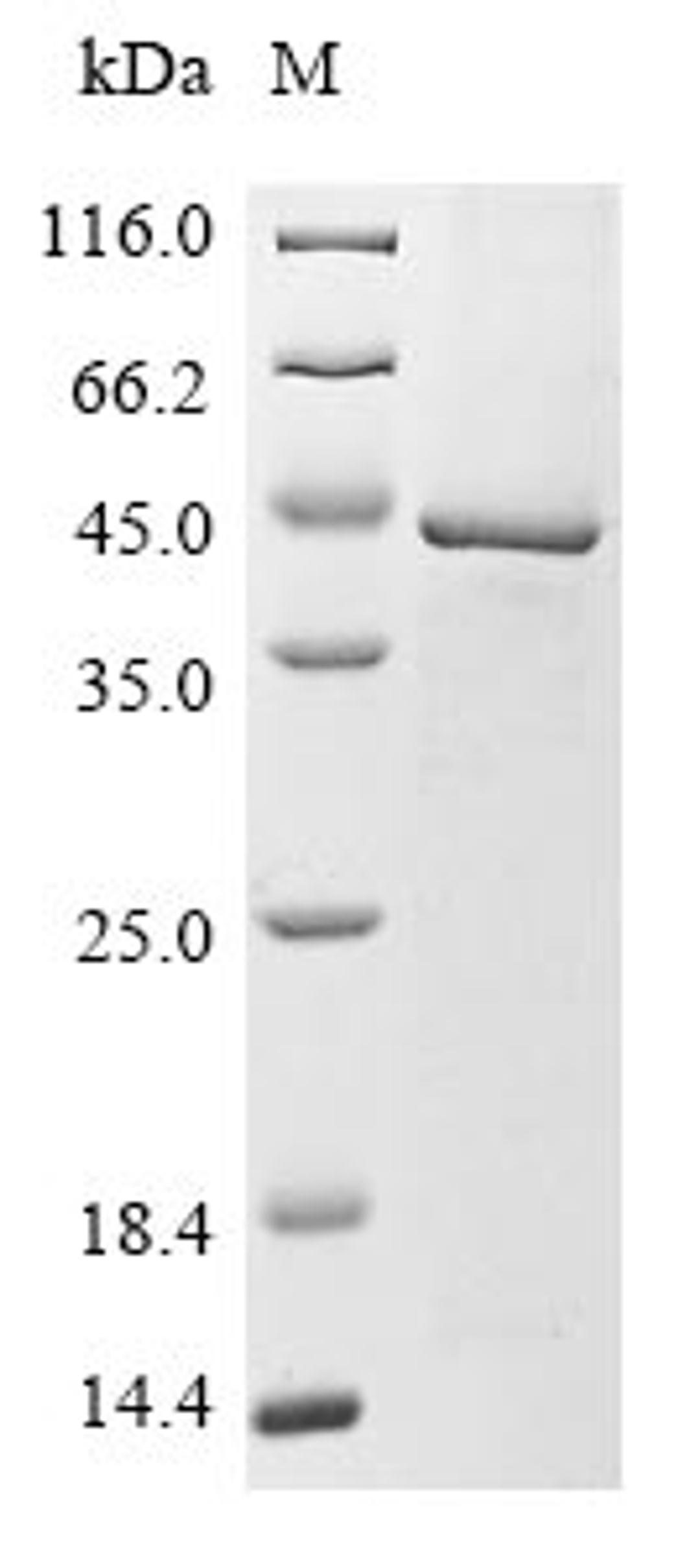 (Tris-Glycine gel) Discontinuous SDS-PAGE (reduced) with 5% enrichment gel and 15% separation gel.