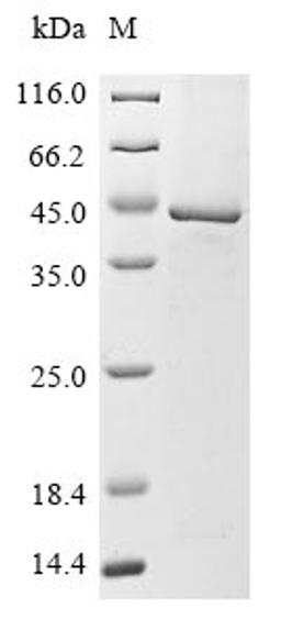 (Tris-Glycine gel) Discontinuous SDS-PAGE (reduced) with 5% enrichment gel and 15% separation gel.