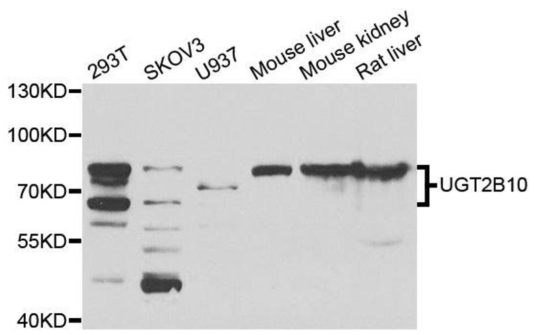 Western blot analysis of extracts of various cell lines using UGT2B10 antibody