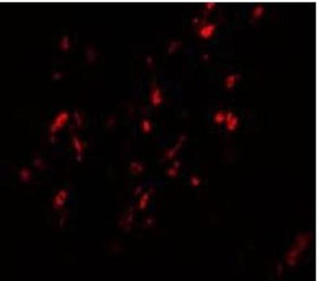 Immunocytochemistry/Immunofluorescence: BCAS1 Antibody [NBP1-77123] - Human Breast Carcinoma cells with BCAS1 antibody at 20 ug/mL.